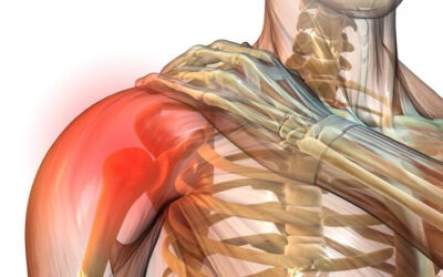 Schulter und Rücken Muskel einklemmen Ursache?