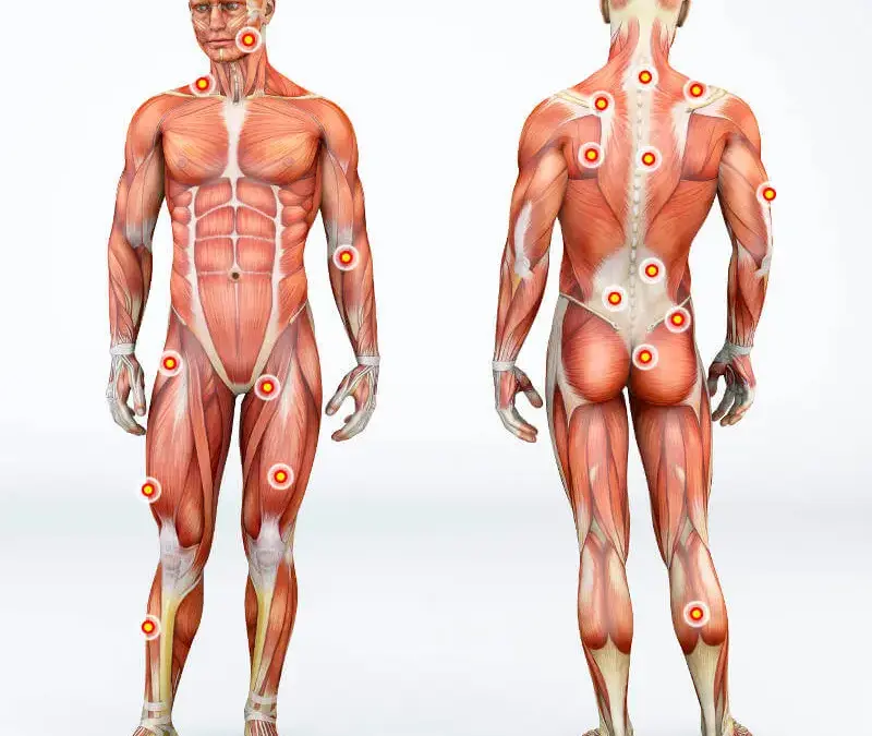 Was ist die Triggerpunkttherapie?